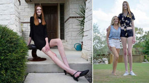 At 17 she has the longest legs in the world